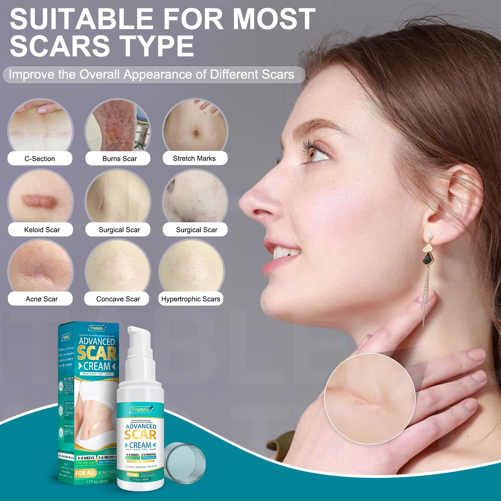 Scar Cream, Silicone Scar Gel, Advanced Scar Gel