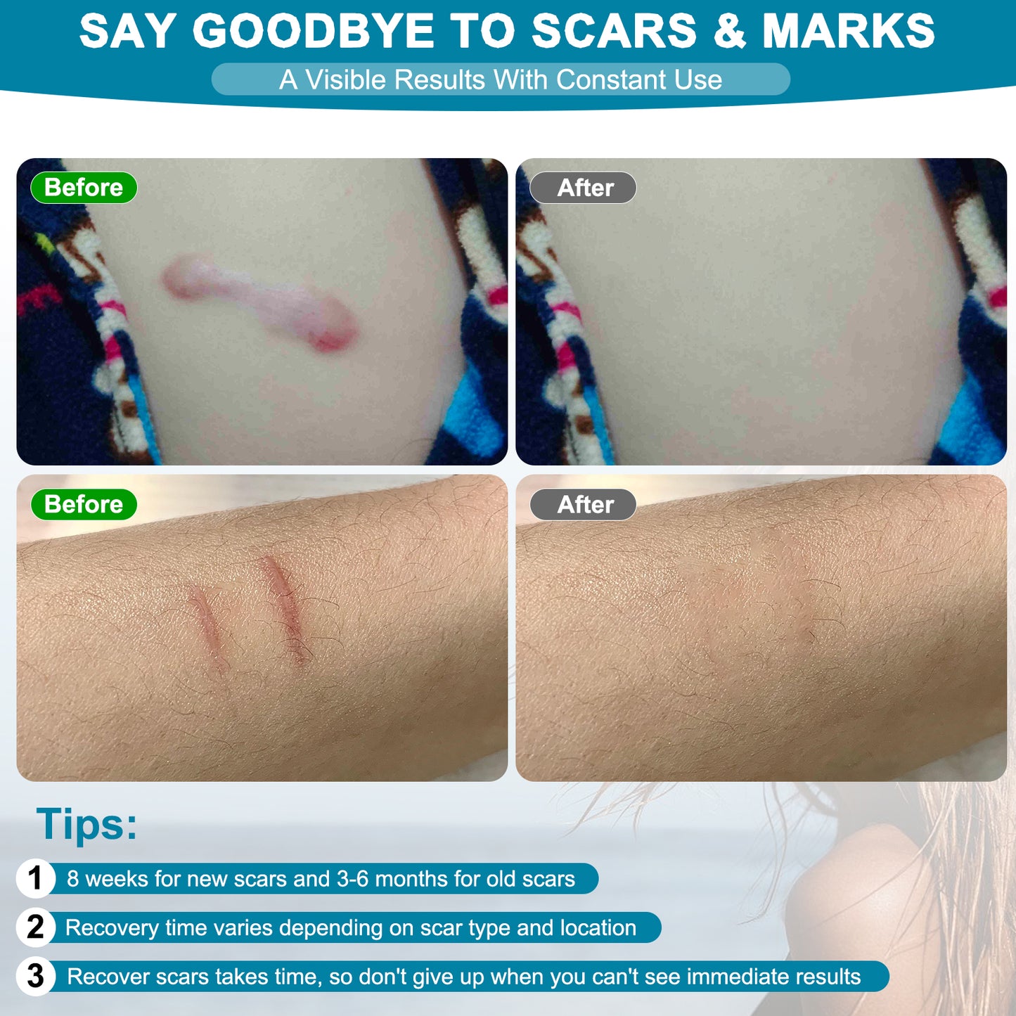Scar Cream, Silicone Scar Gel, Advanced Scar Gel